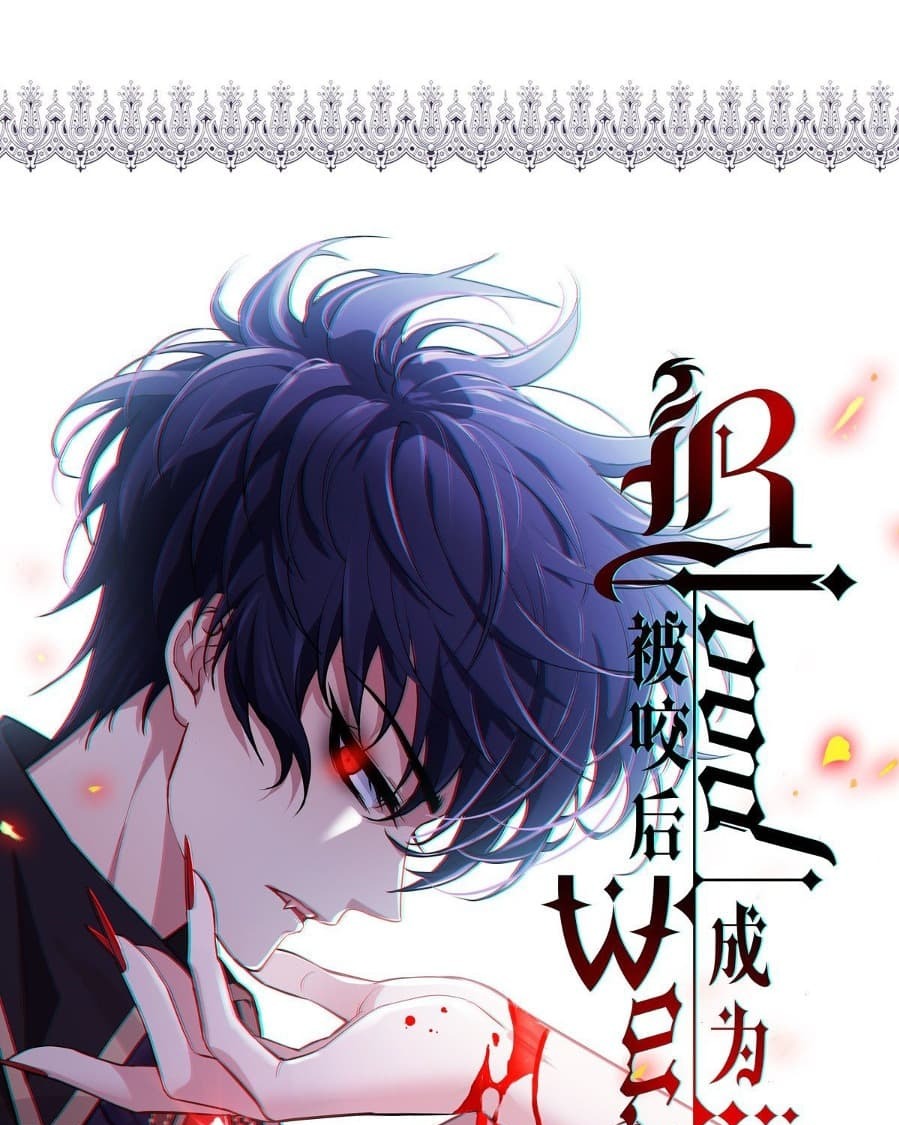 Became King After Being Bitten Chapter 13 Bahasa Indonesia