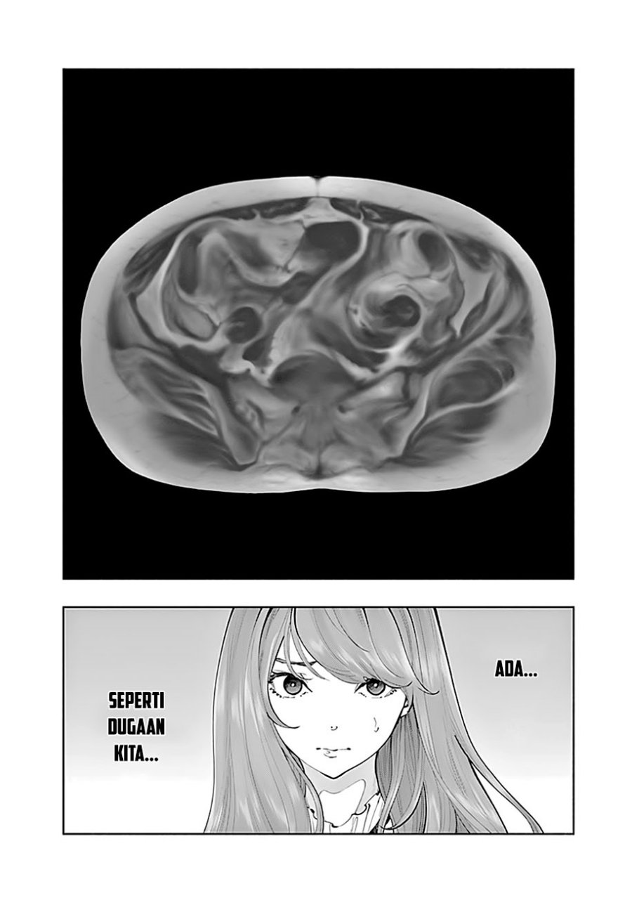 Radiation House Chapter 67 Bahasa Indonesia